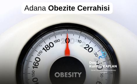 Adana Obezite Cerrahisi Rehberi: Doç. Dr. Kuntay Kaplan ile Tüp Mide Ameliyatı Hakkında Her Şey