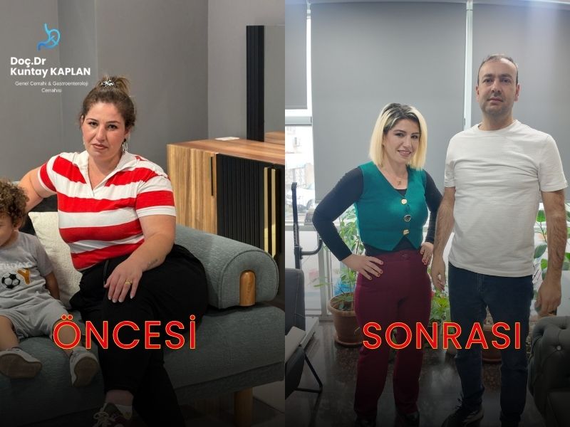Adana Obezite Cerrahisi Başarı Hikayesi