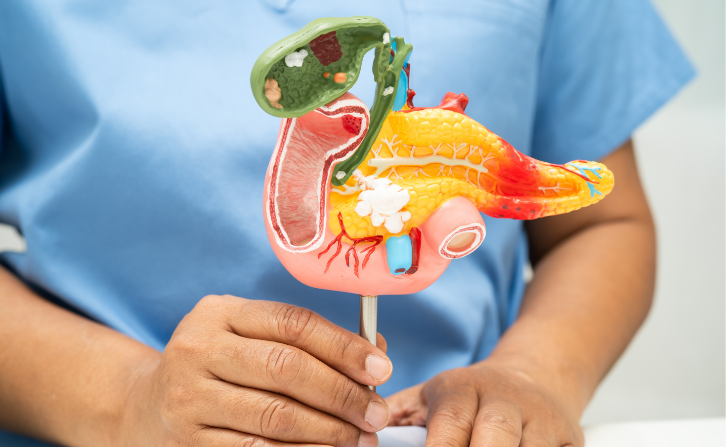 Duodenum Divertikülü Nedir? Belirtileri ve Tedavi Yöntemleri