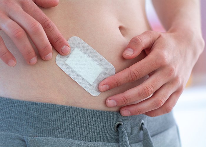 Epigastrik Herni Cerrahisi (Göbek Üstü Fıtığı Ameliyatı)