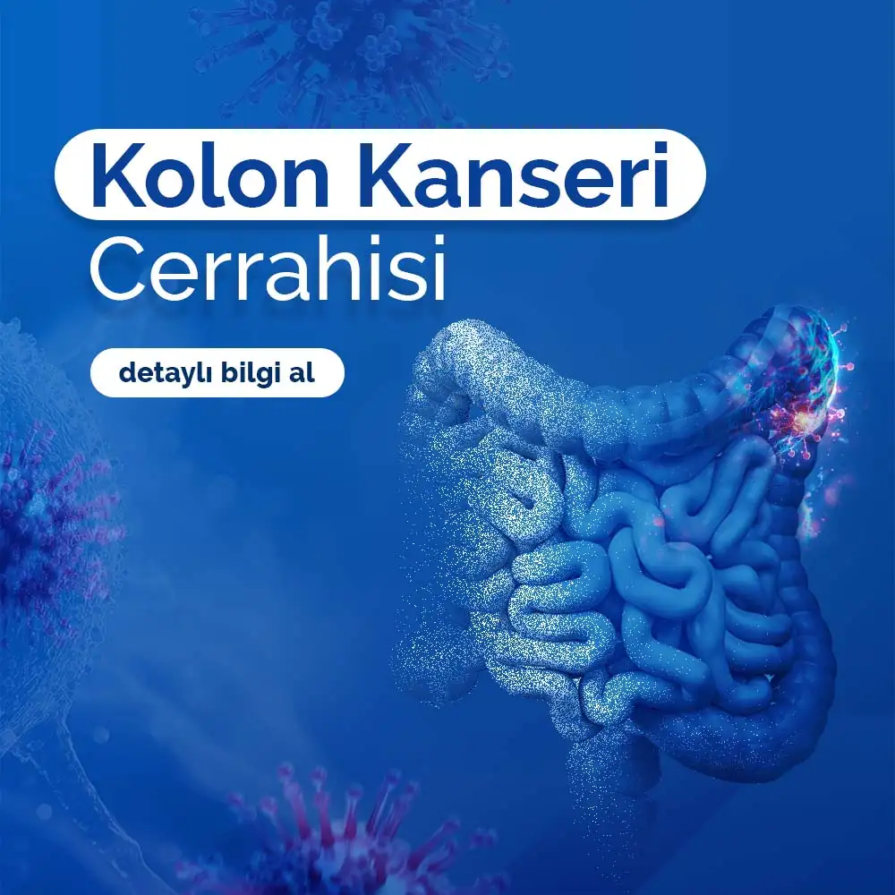 Kolon Kanseri Cerrahisi | Adana Doç. Dr. Kuntay Kaplan