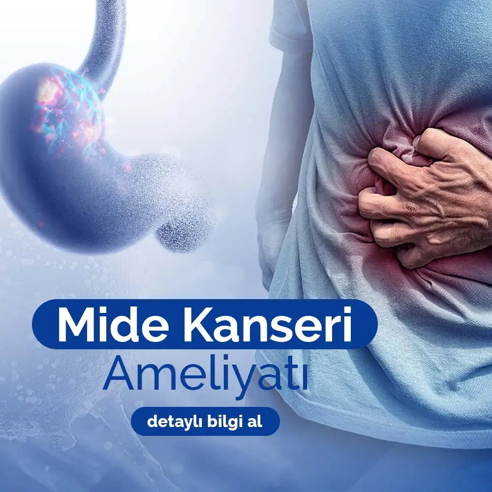 Mide Kanseri Ameliyatı | Adana Doç. Dr. Kuntay Kaplan