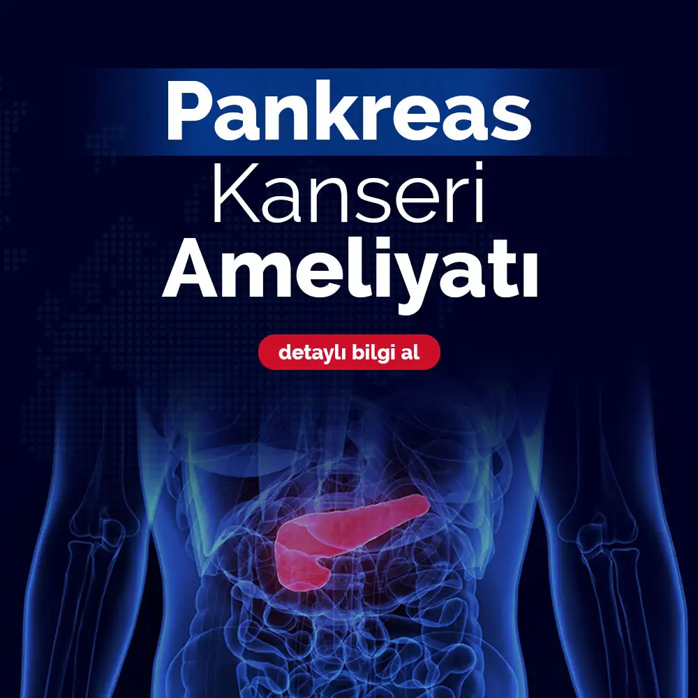 Pankreas Kanseri Ameliyatı | Adana Doç. Dr. Kuntay Kaplan