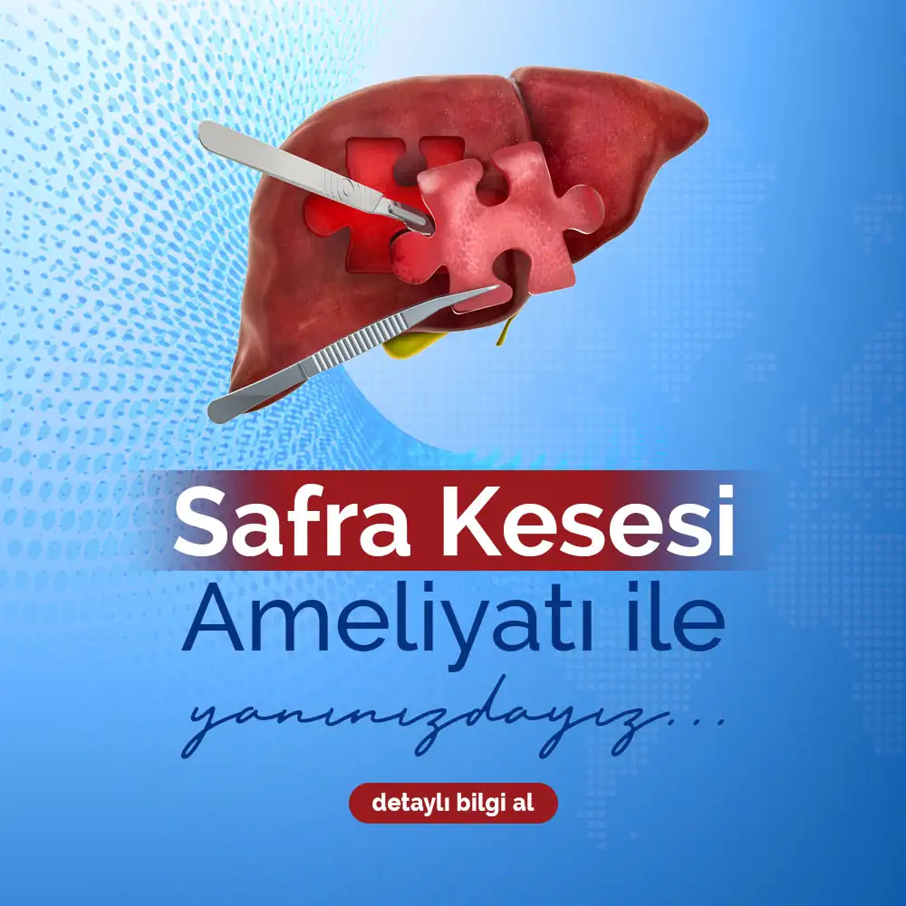 Safra Kesesi Ameliyatı ile Yanınızdayız | Adana Doç. Dr. Kuntay Kaplan